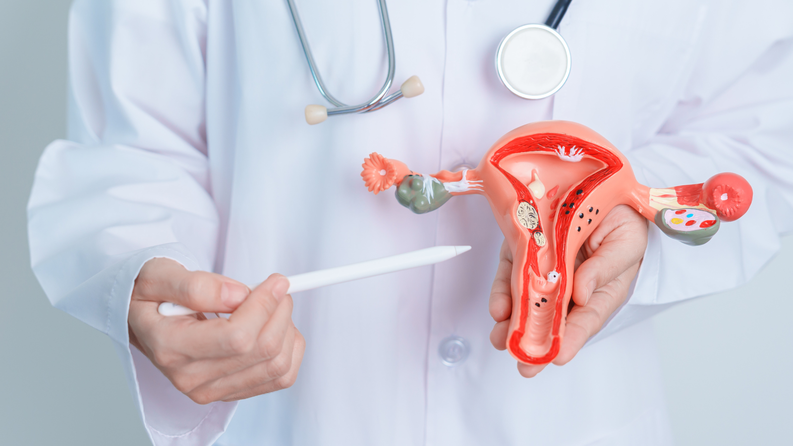 The 4 main types explained simply