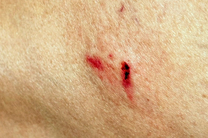 Nhiều người ở Đồng Nai bị khỉ hoang tấn công khi đang ở trong phố