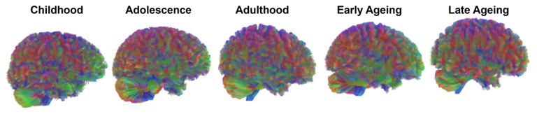 Scientists identify five distinct ages of the human brain