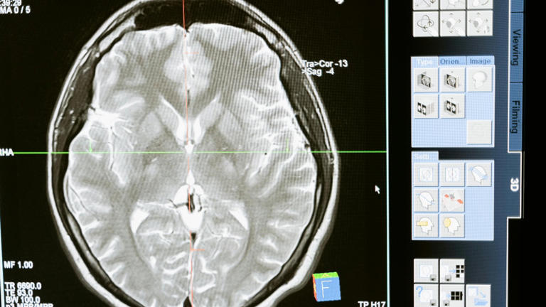 The age of brain weapons is coming and we are not ready