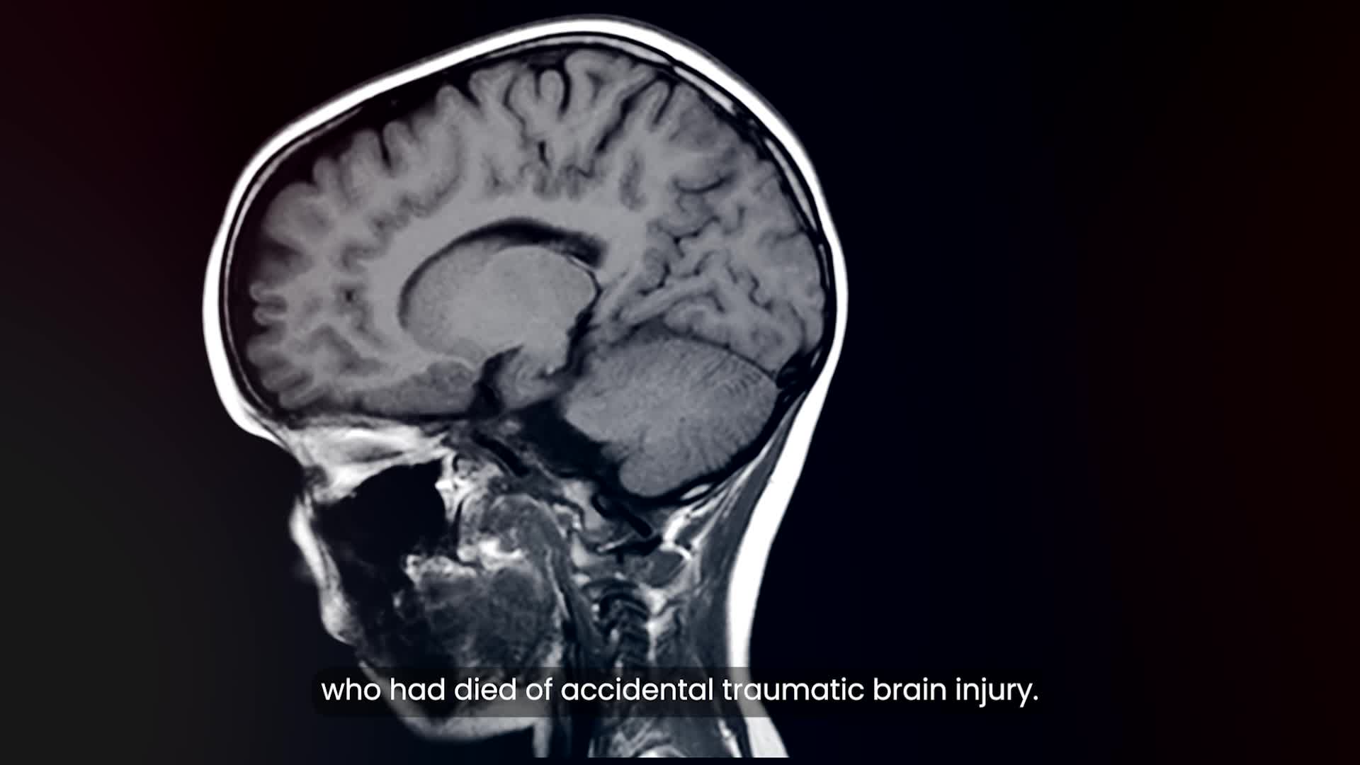 Scientists Reveal Turning Point When Your Body's Aging Accelerates