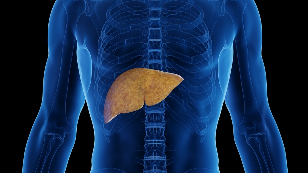 3d,Rendered,Medical,Illustration,Of,Male,Anatomy,-,Fatty,Liver.