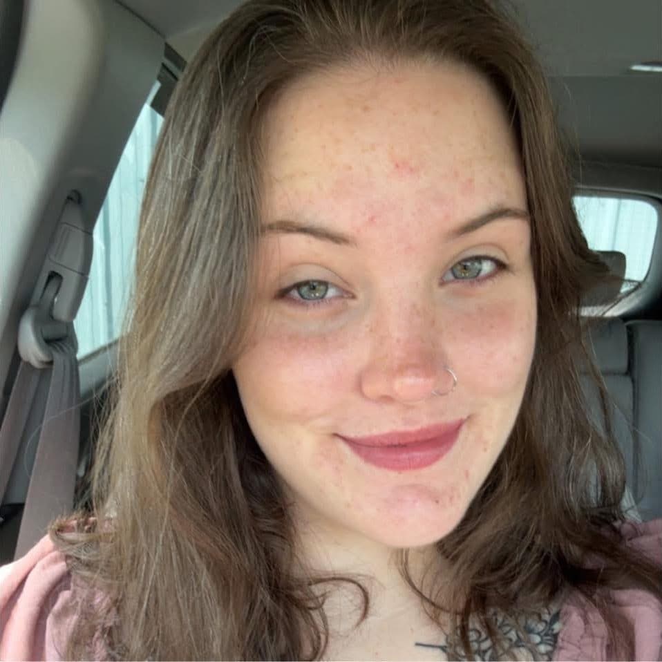 Sarah Beckstrom died from her injuries following the shooting