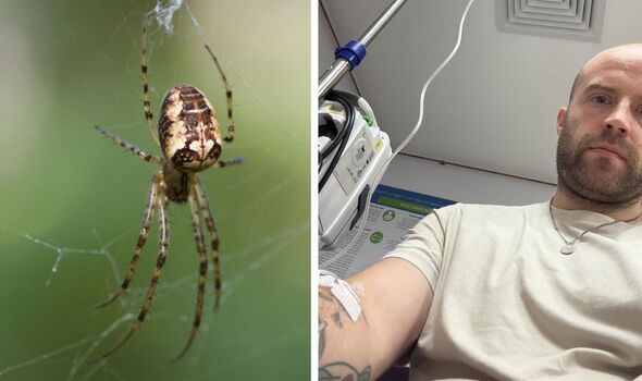 A spider bite in the UK left me on a drip in hospital and taught me 1 ...