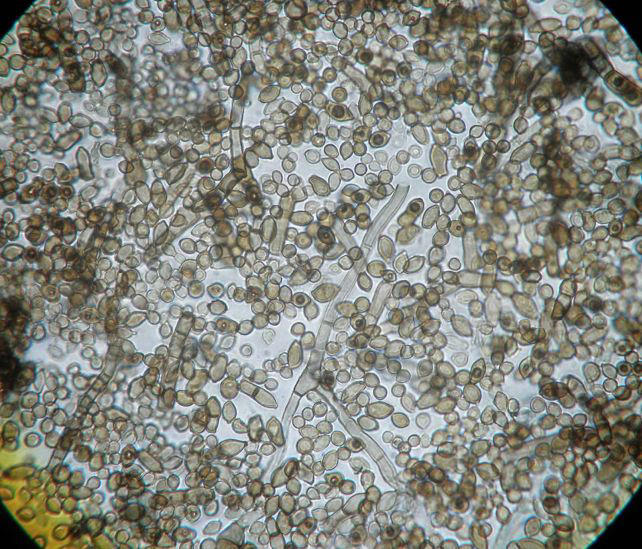 Chernobyl Fungus Appears to Have Evolved an Incredible Ability