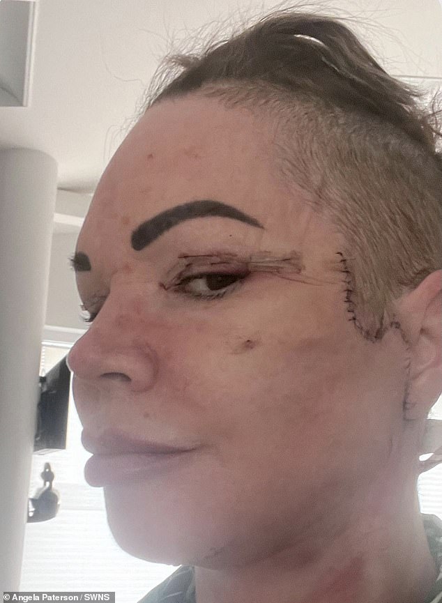 Businesswoman who flew to Lithuania for £7k surgery was left 'with