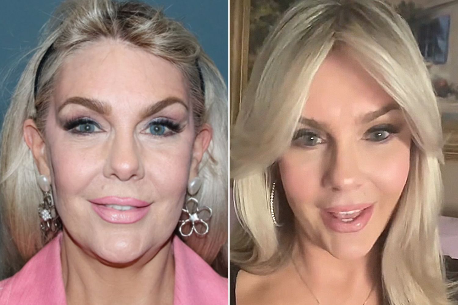 61YearOld Woman Goes Viral After Sharing Her Cosmetic Procedures to