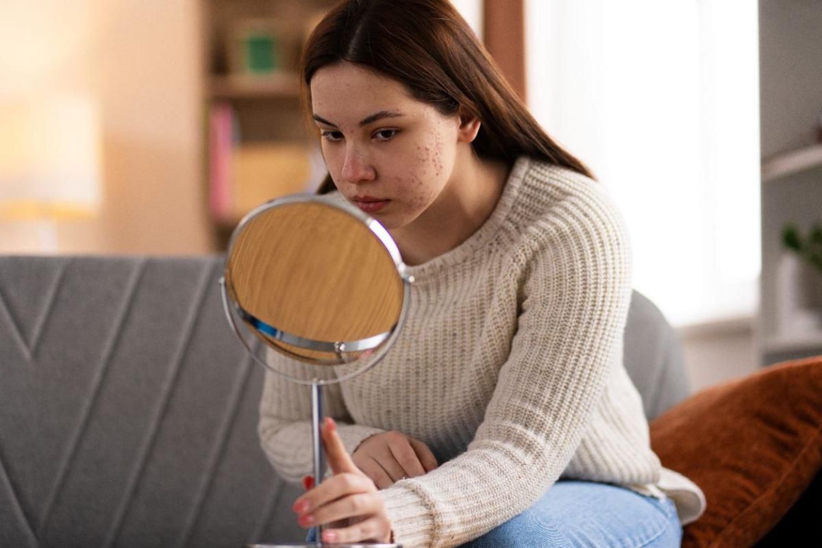 Apakah Retinol Bisa Atasi Jerawat? Ini Fakta Lengkapnya