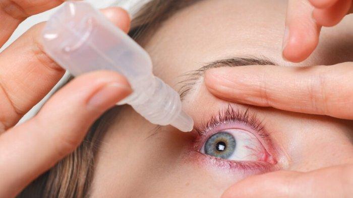 7 Tips Cegah Mata Kering, Jaga Kesehatan Mata