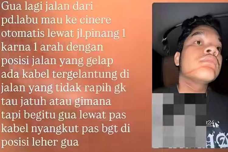 Pengendara Motor Terluka Akibat Kabel Menjuntai di Cilandak