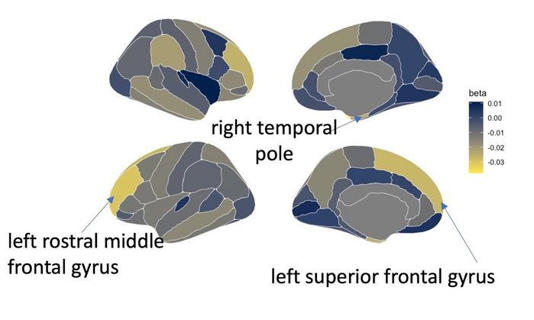 This study found evidence that children with higher screen time exhibit measurable differences in the volume and thickness of several key brain areas.