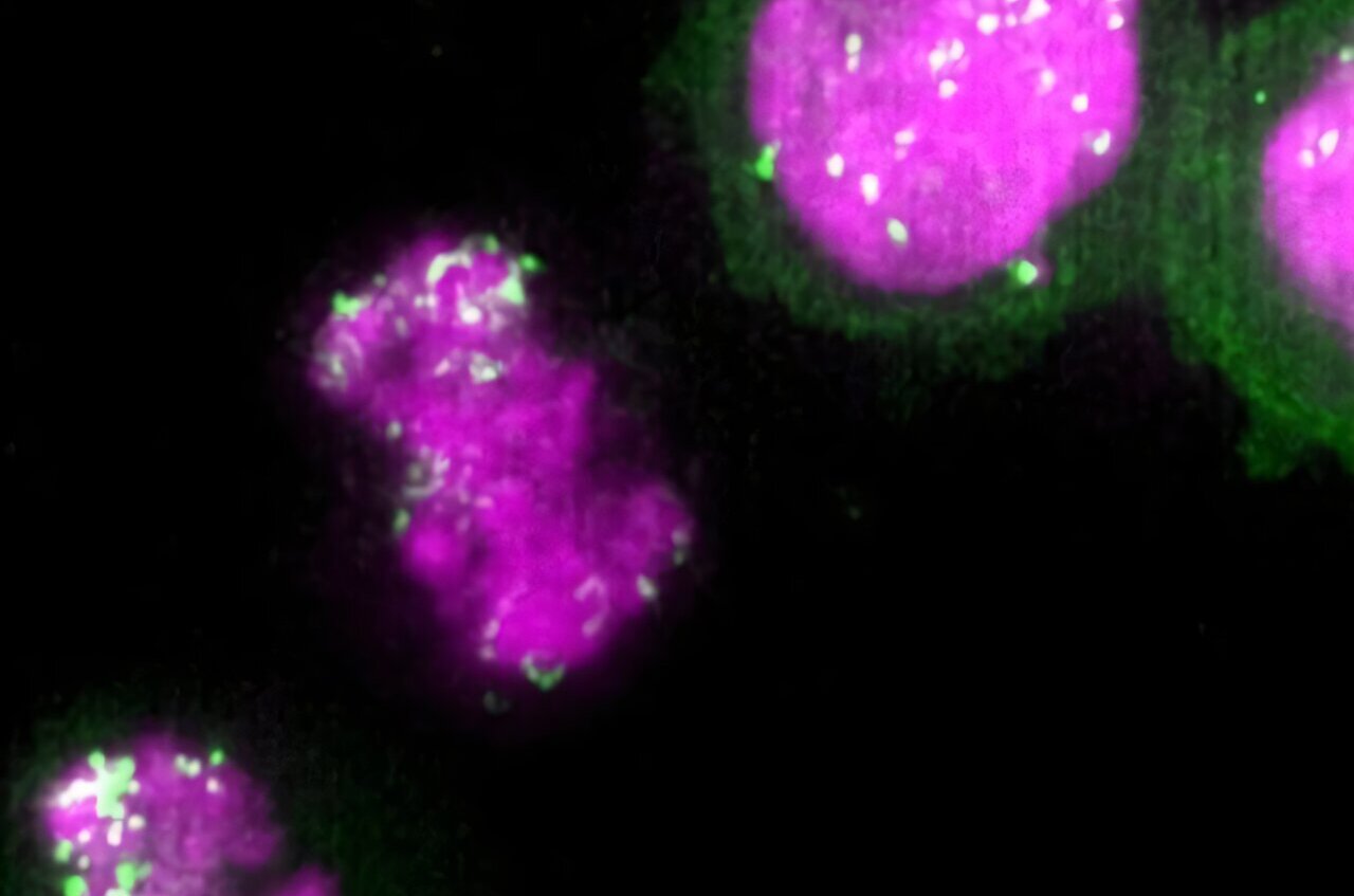 Cancer-promoting DNA circles hitchhike on chromosomes to spread to ...