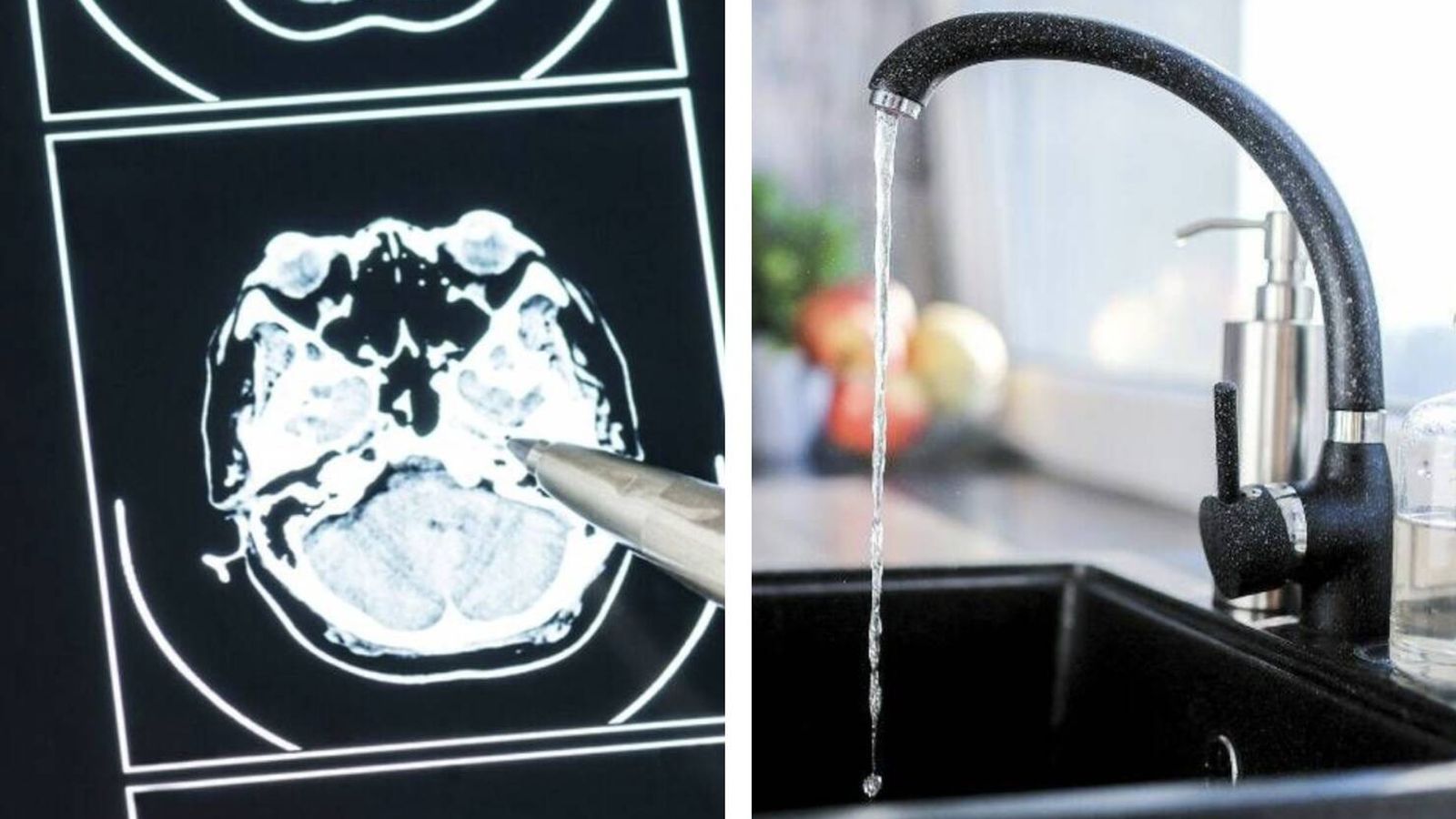 El mayor estudio de la historia te explica si beber agua con flúor es ...