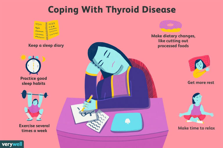 Thyroid fatigue symptoms and treatments