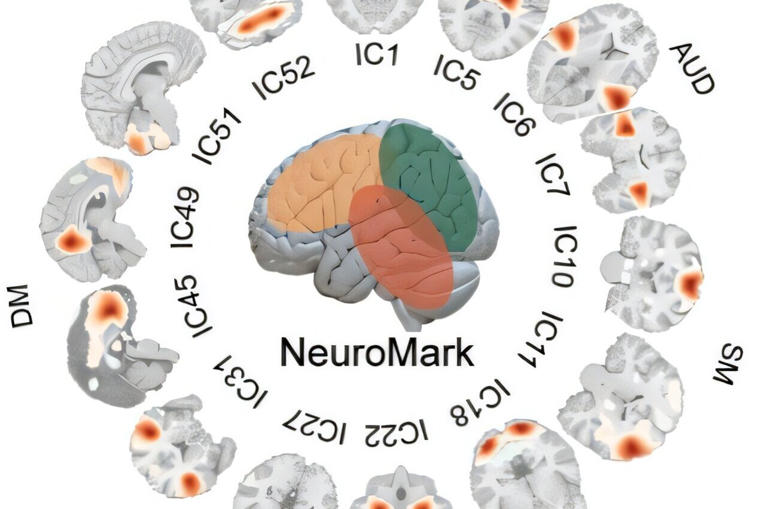 Brain researchers draw cellular blueprint for how we think and feel