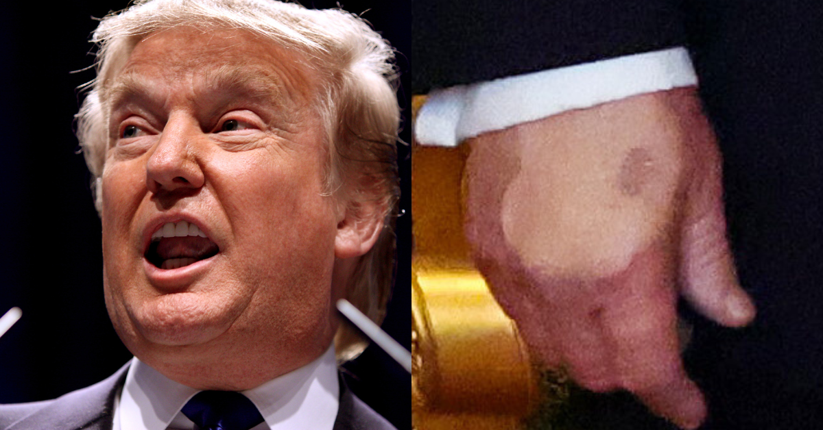 Beauty experts reveal what’s really going on with Trump’s odd faceand