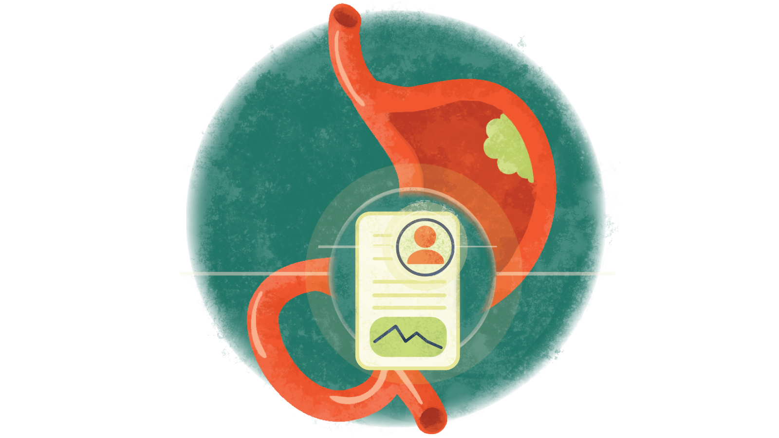 Case study: Getting to the correct diagnosis was complicated by 'deceptive rectal metastasis'