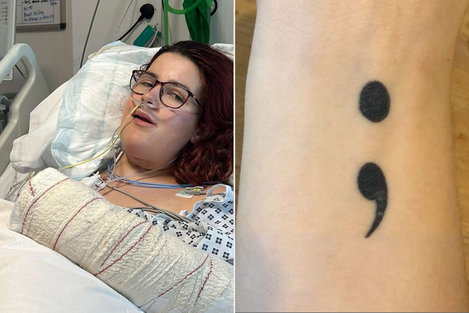 Histopathology of body art revisited – analysis and discussion of 19 cases  - Körner - 2013 - JDDG: Journal der Deutschen Dermatologischen Gesellschaft  - Wiley Online Library, image size:1500x1000