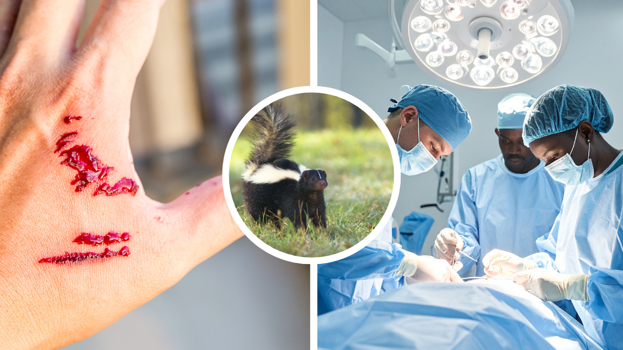 Diagnostic anomaly: In an 'exceptionally rare' case, man dies of rabies ...
