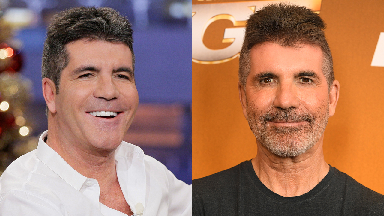 Simon Cowell admitted he went 'too far' with his face as friends are ...