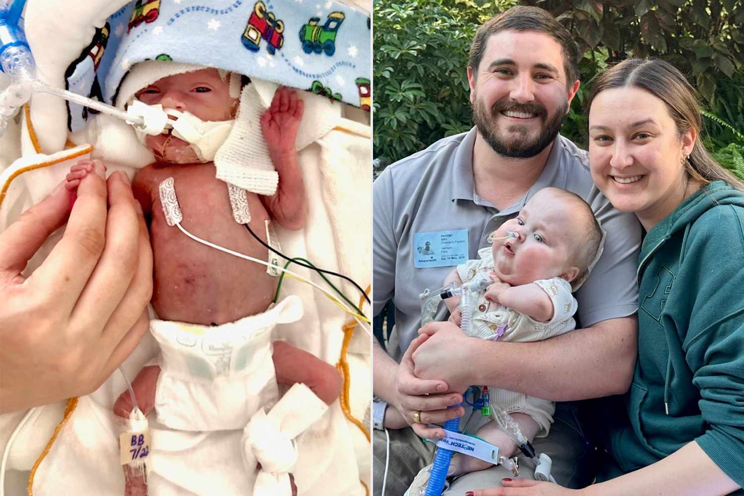 Doctors told mom 'nothing else' could be done to save tiny preemie born(00)