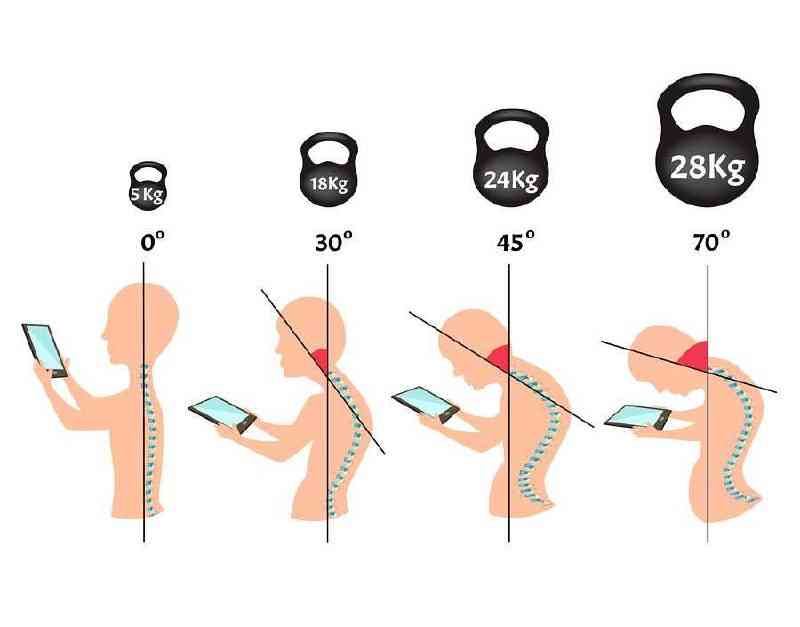 Waspadai! Terlalu lama menunduk bisa picu sindrom leher teks