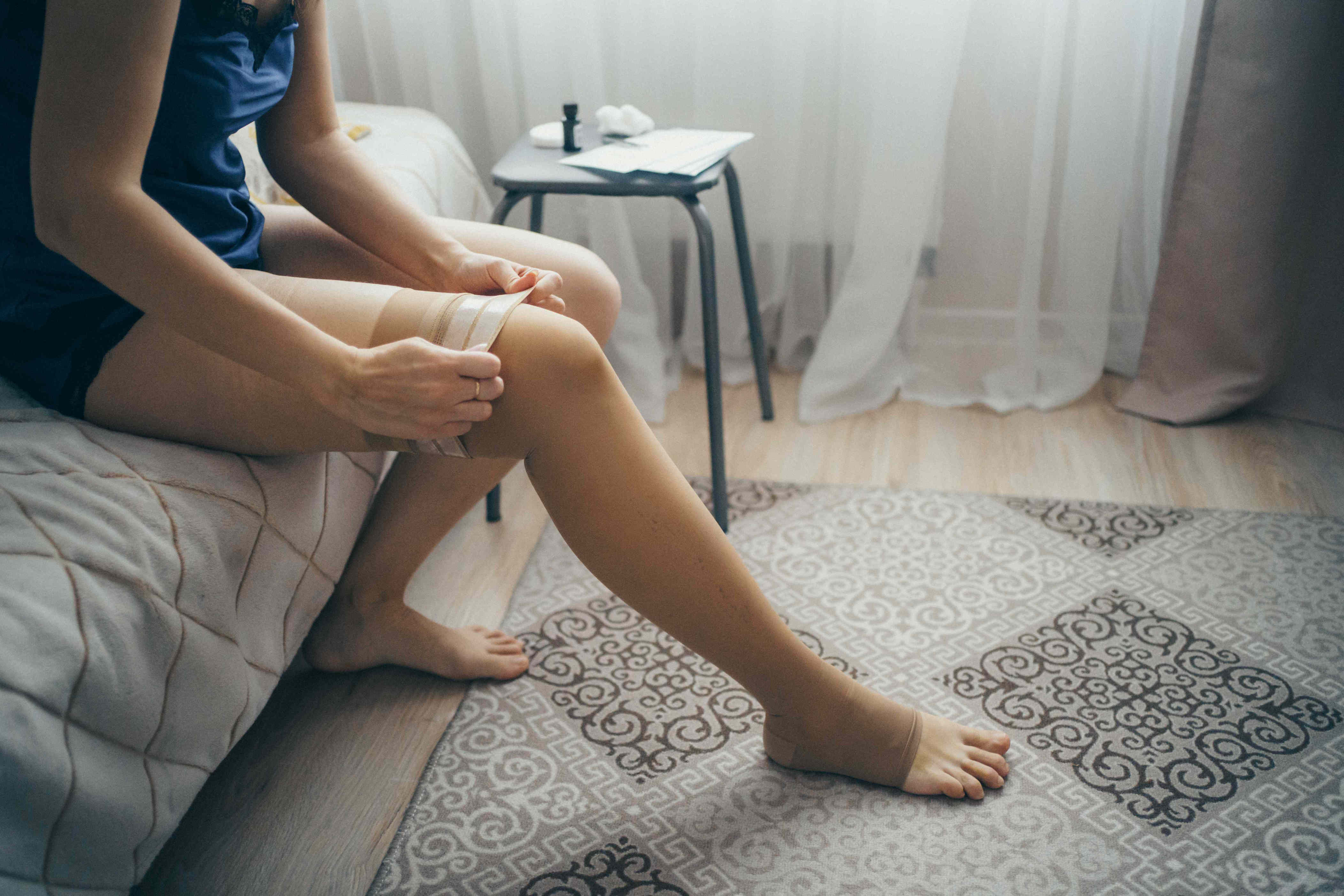 What to know about varicose veins, during pregnancy and after