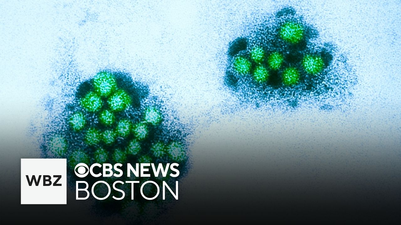 More than 130 students out sick after suspected norovirus outbreak at ...