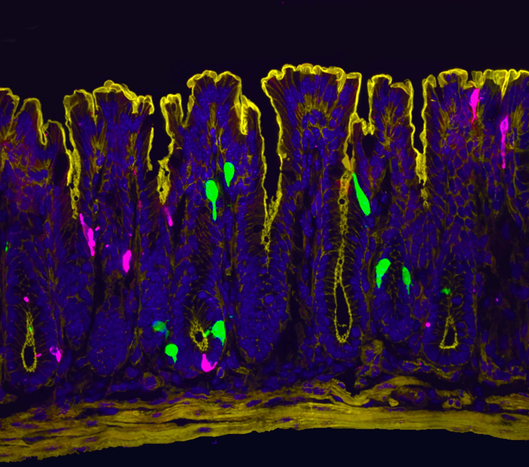 Why women are more likely to suffer IBS pain