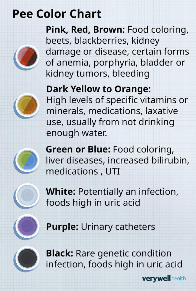 Urine color chart: What your pee can tell you