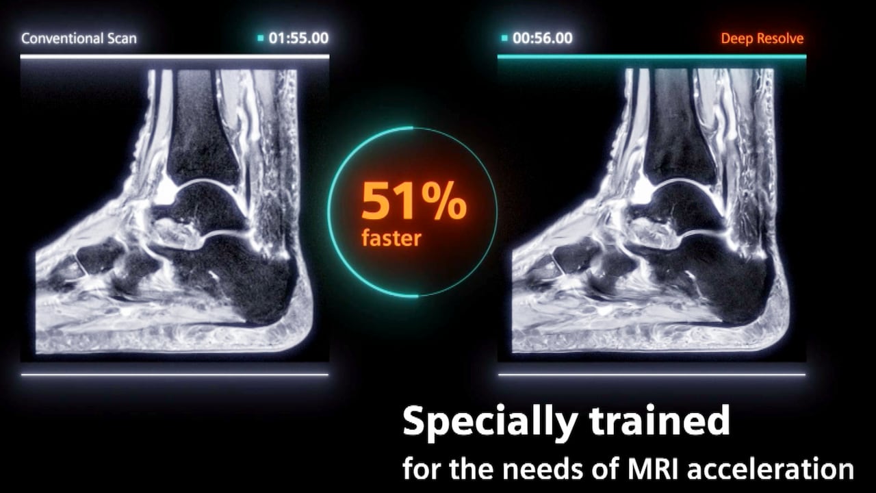 How is artificial intelligence used in Manitoba's health-care system?