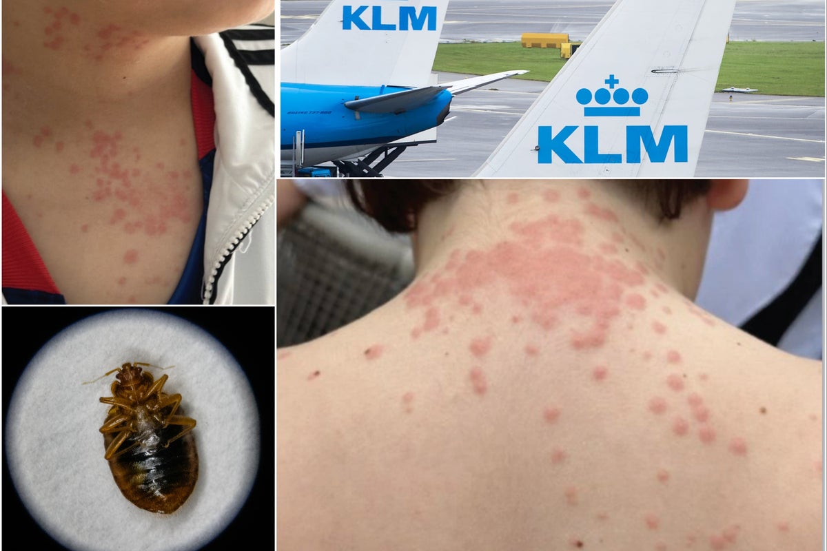 Family ambushed by bed bugs aboard flight sues over ruined trip