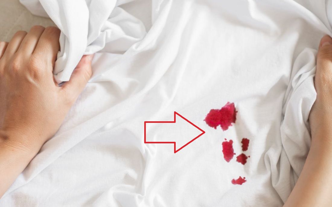 3 cara efektif menghilangkan noda darah di sprei dengan bahan kuah bakso