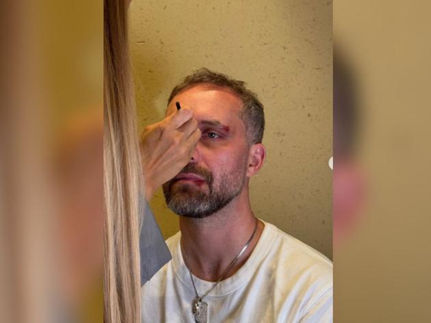 Mark Forster ohne Mütze: So zeigte er sich kürzlich bei Instagram.