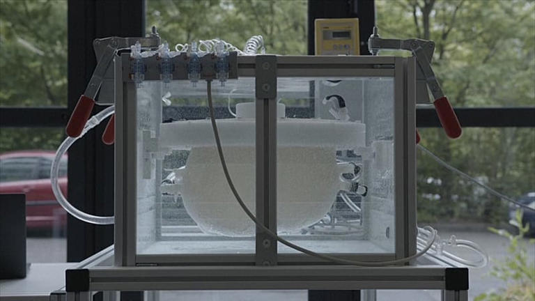This 'artificial womb' could save the lives of extremely premature babies