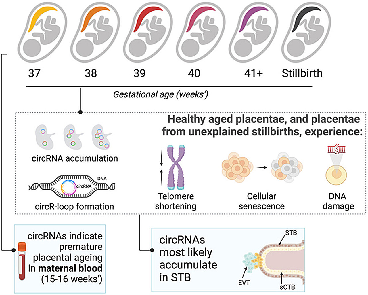 New clues to preventing stillbirth: Research highlights premature ...