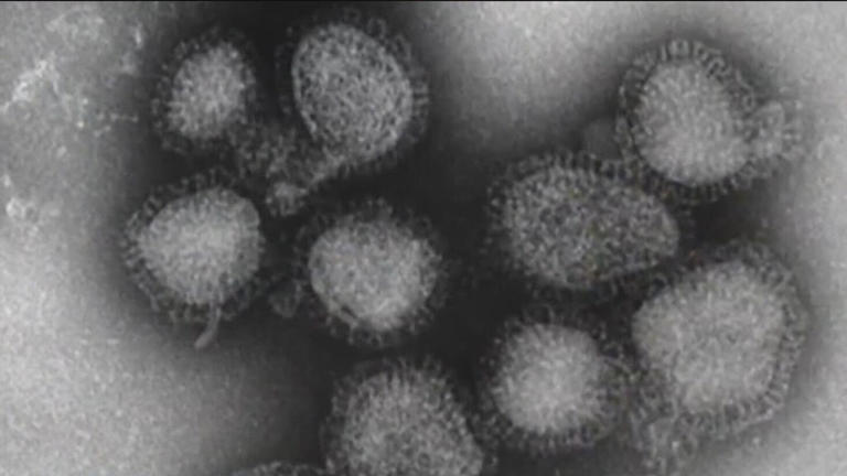 Doctors in Chicago warn about possible surge in flu cases as new strain ...