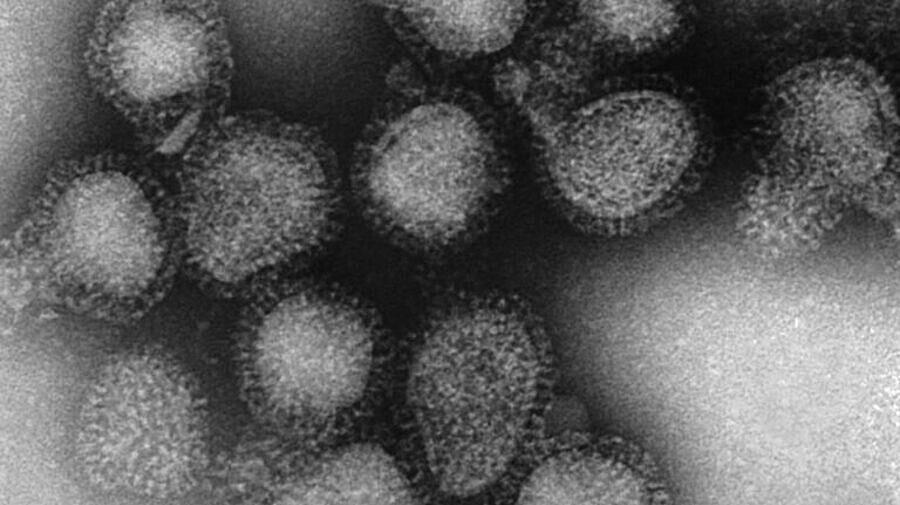 Vì sao đột biến K của chủng virus H3N2 được chú ý?