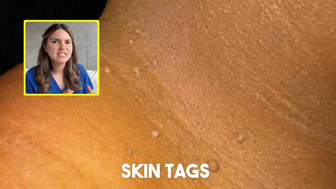This is not normal — what doctors notice first on the skin