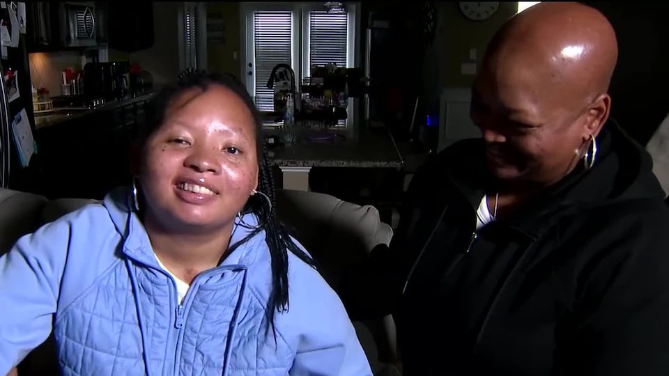 'Miracle' teen standing, talking after brain injury from crash