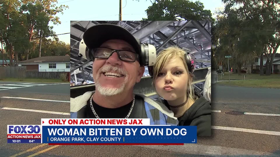 Father says woman is spending Christmas in hospital after dog attack