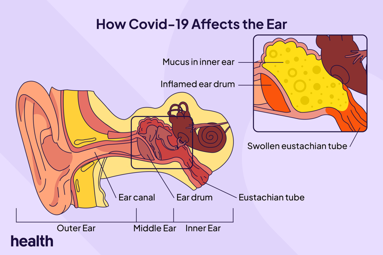CAN COVID CAUSE EAR PAIN OR INFECTIONS visual data 4