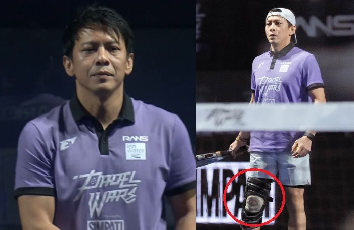 Kronologi Luka Meniskus Ariel NOAH, Sudah 3 Kali Sedot Cairan di Lutut!