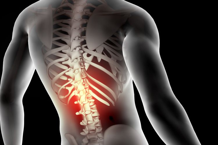 Bedah Tulang Belakang Lebih Akurat dengan Teknologi Neuronavigation