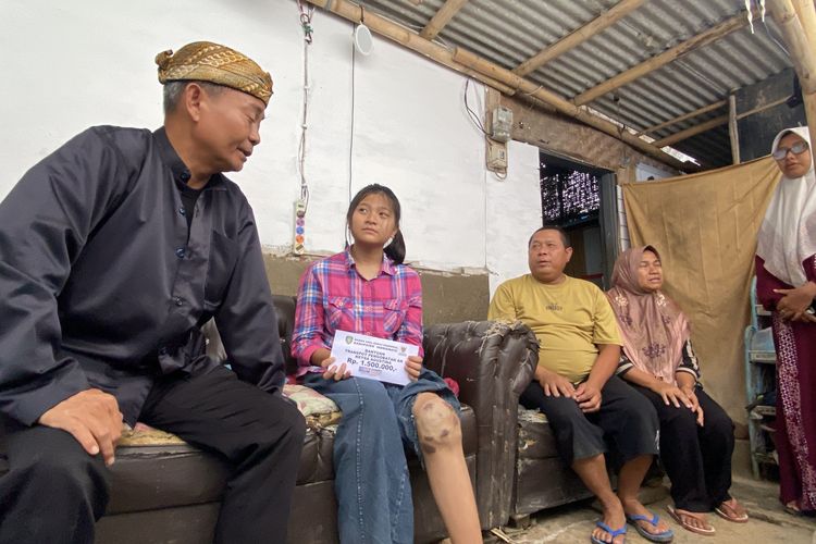 Anak Indramayu yang Viral karena Tumor Kini Dapat Bantuan Pemerintah