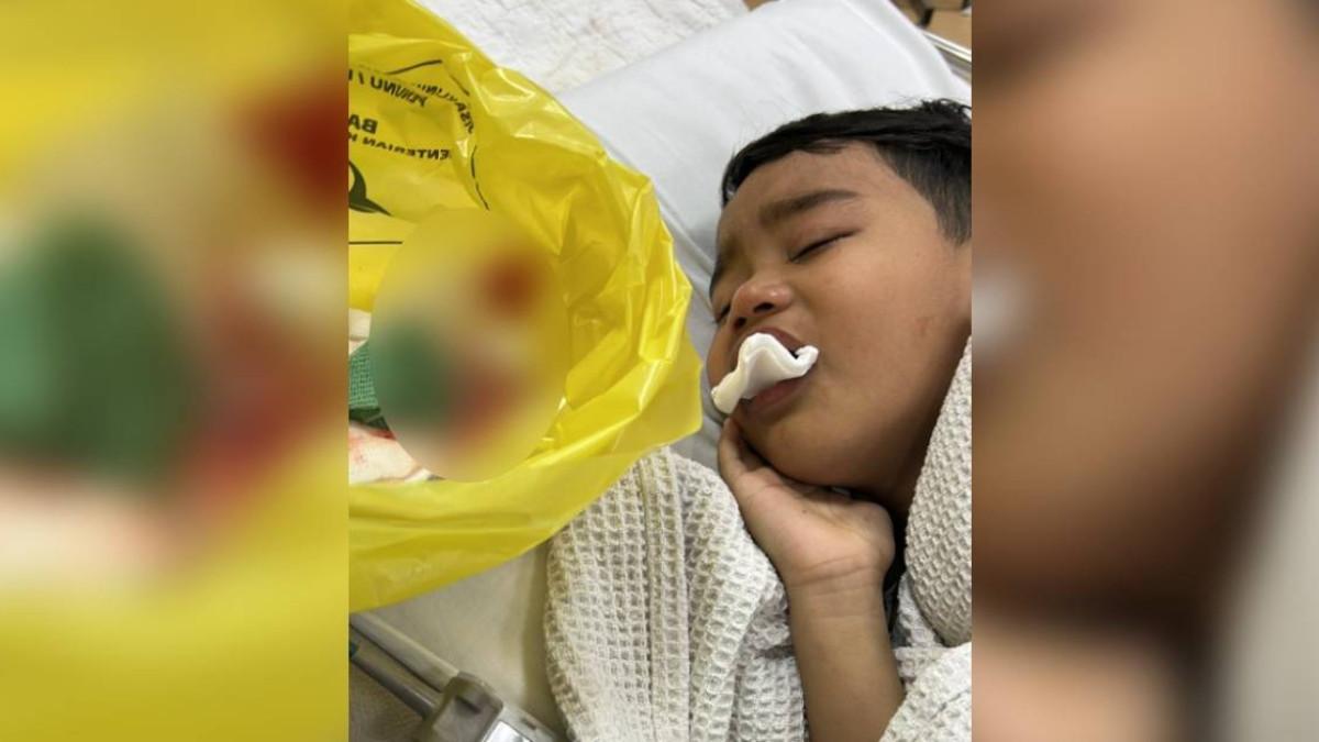 Anak Laki-Laki di Malaysia Kehilangan 12 Gigi karena Tidur dengan Botol Susu