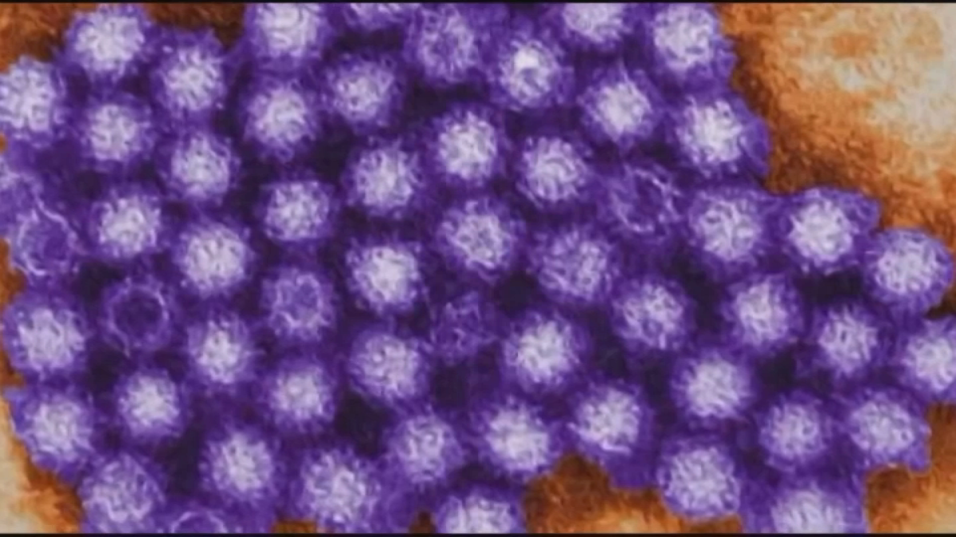 Highly contagious, hard-to-kill stomach virus spreading in Midwest ...