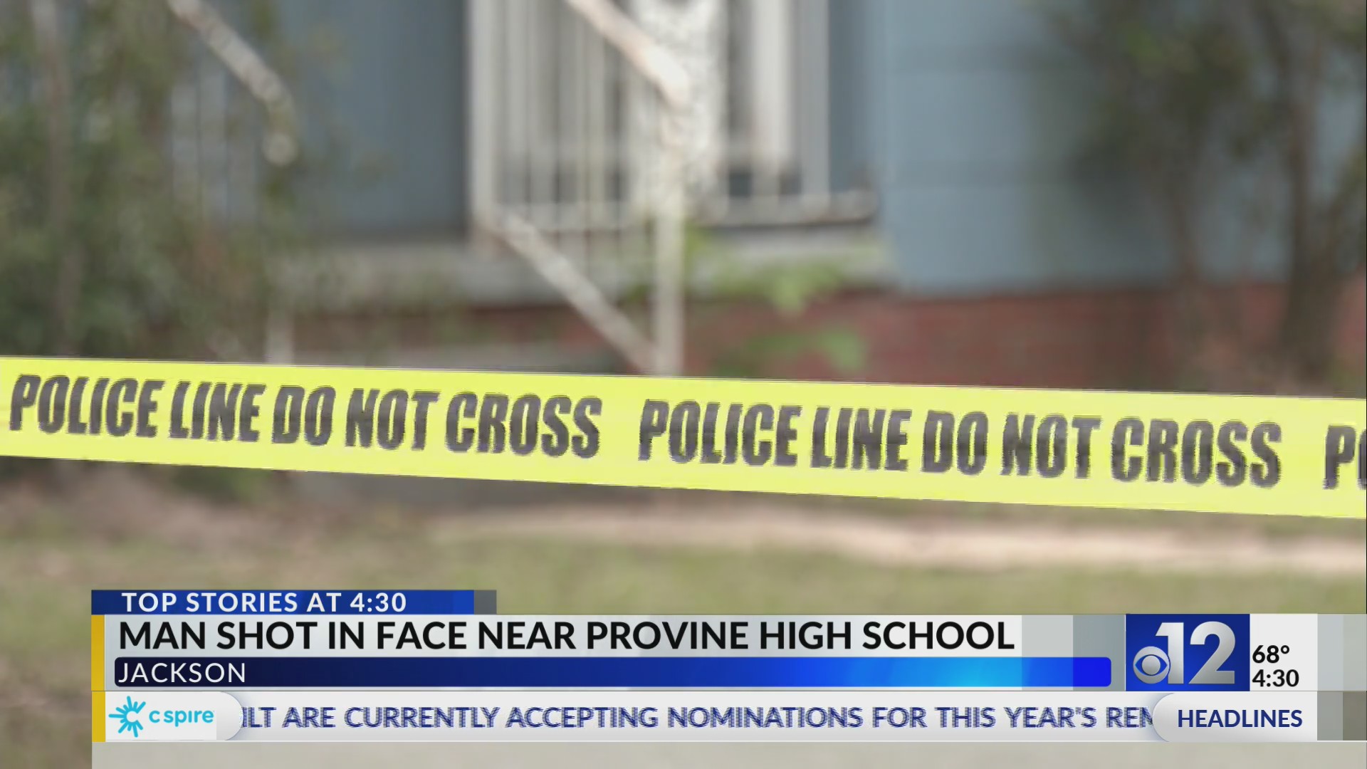 Man hospitalized after being shot in face in Jackson