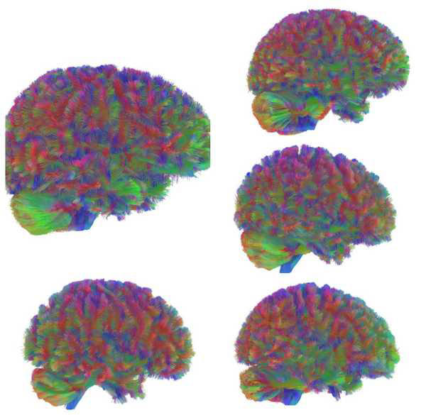 Cérebro tem uma 'adolescência estendida' até os 32 anos; entenda