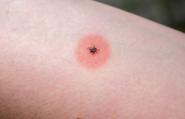 Doctors issue warning for 'potentially life-threatening' illness spread ...